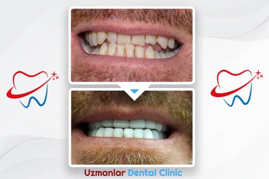 Slider image (7) Uzmanlar Dental Clinic
